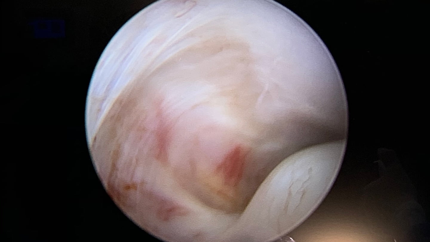 Tratamento ATM Porto Alegre