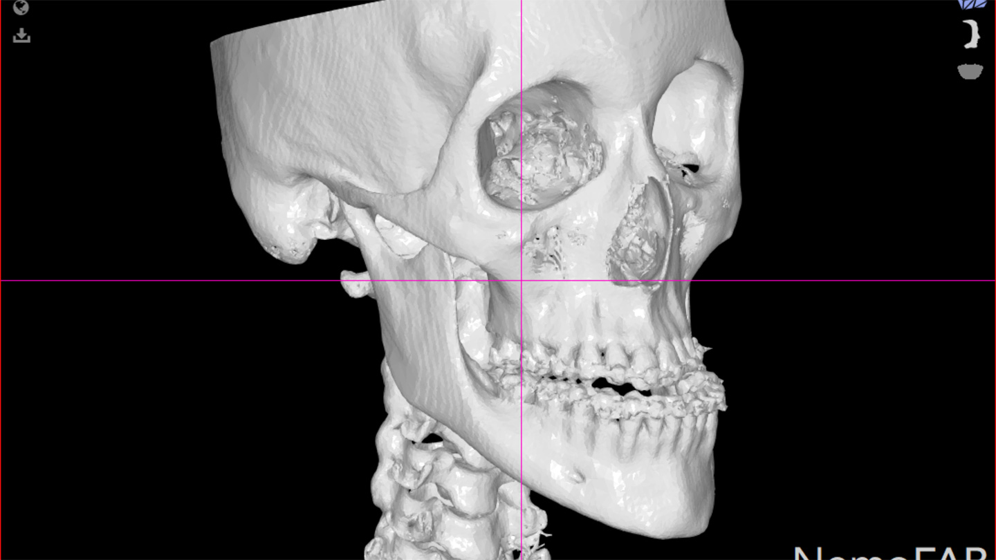 Cirurgia Ortognática Porto Alegre