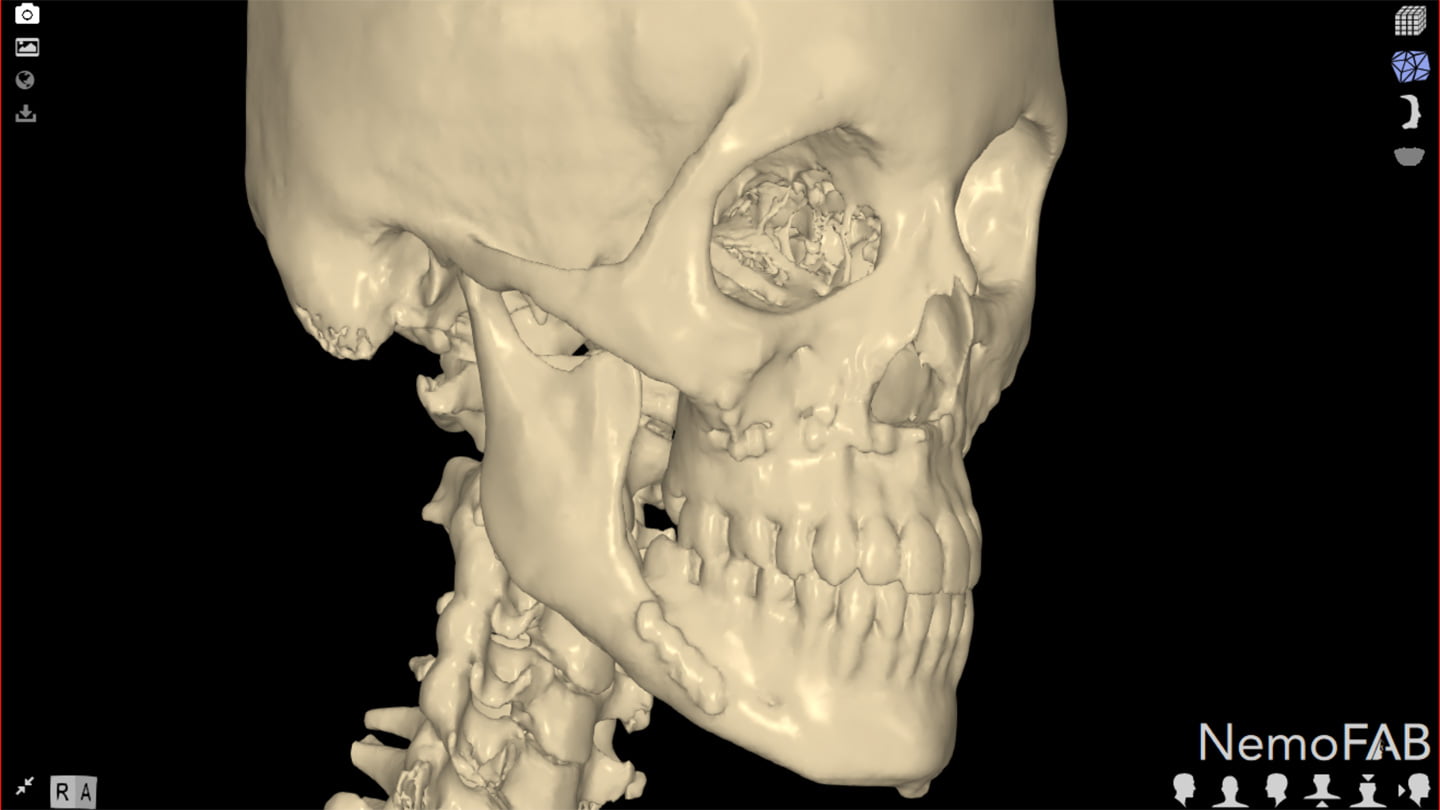 Cirurgia Ortognática Porto Alegre