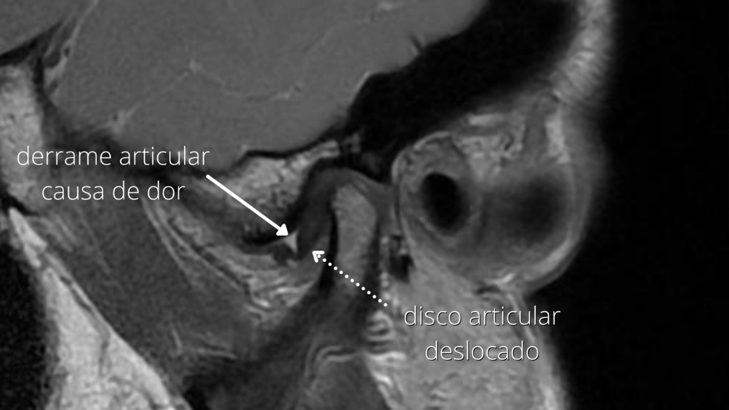 Tratamento ATM Porto Alegre