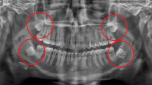 Especialista em Cirurgia Oral POA