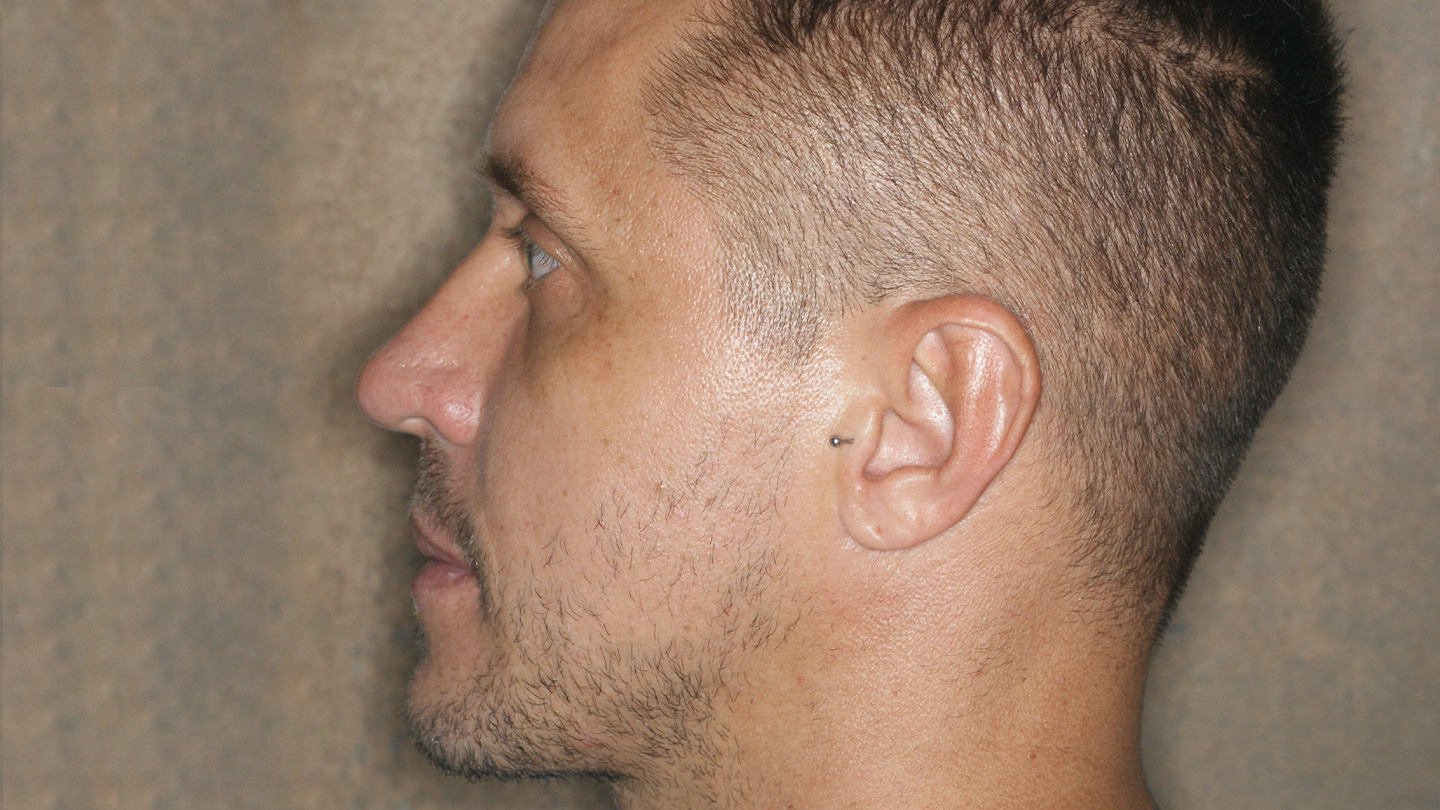 Cirurgia Ortognática Porto Alegre